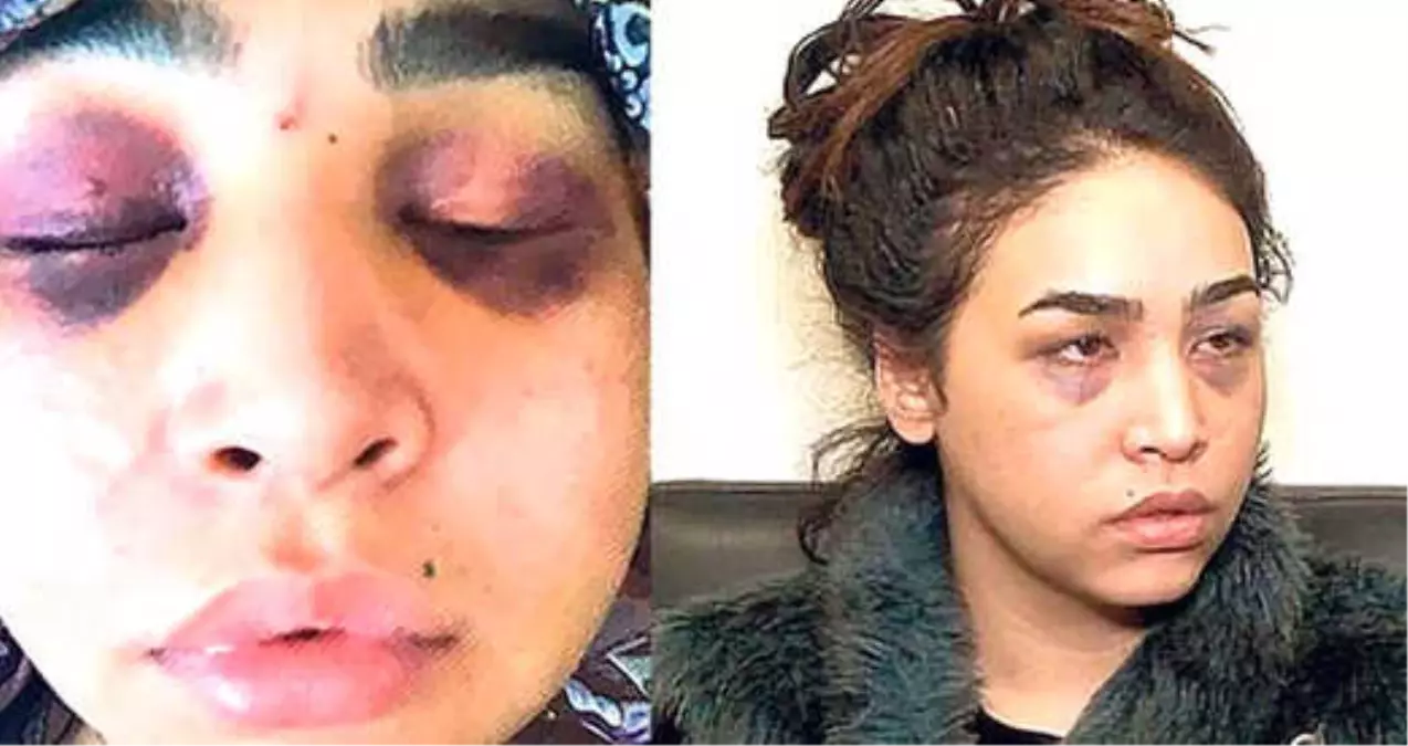 Demir Çubukla Şiddet Gören Genç Kız, Canlı Yayında Bulundu