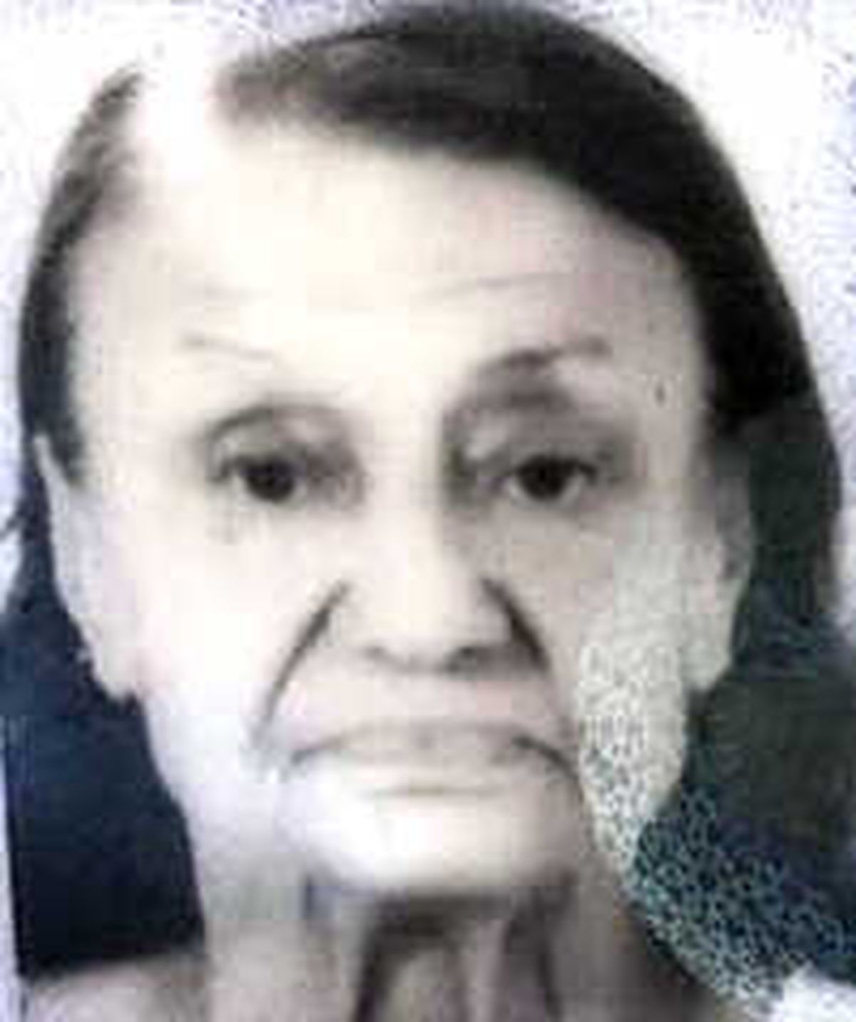 Alzheimer Hastası Yaşlı Kadın Balkondan Düşüp Öldü