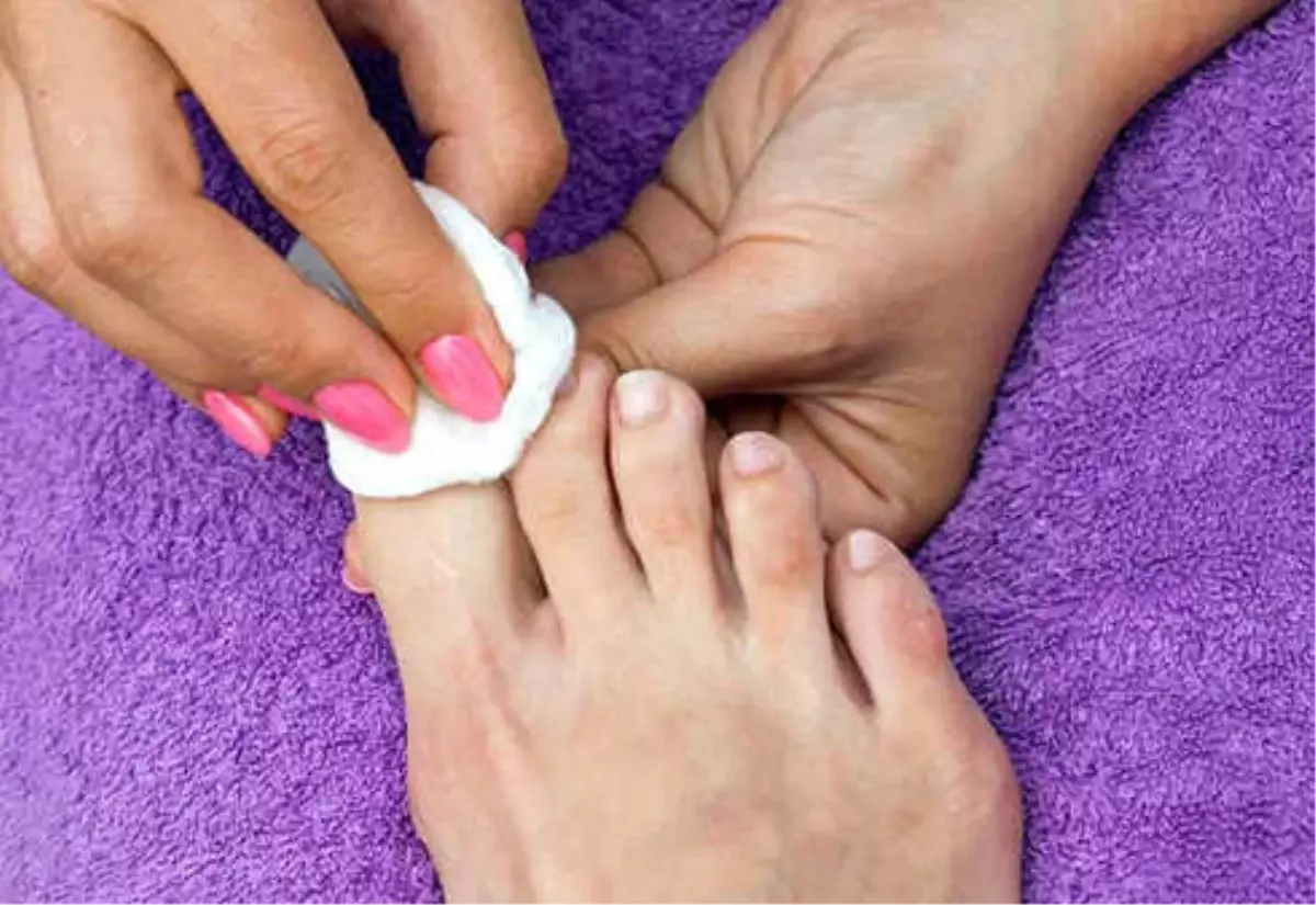 Ayak Tırnak Mantarına İlaç Gibi Tavsiyeler