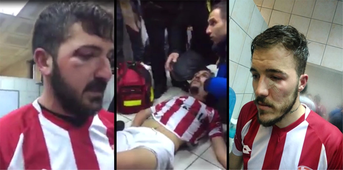 Yeni Çanspor\'lu Futbolcular Saldırıyı Anlattı