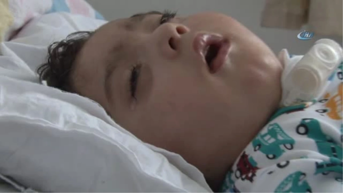 Havale Geçirip Yatağa Mahkum Olan Bebek, Kurtulmak İçin 1 Milyon TL\'lik Ameliyat Bekliyor