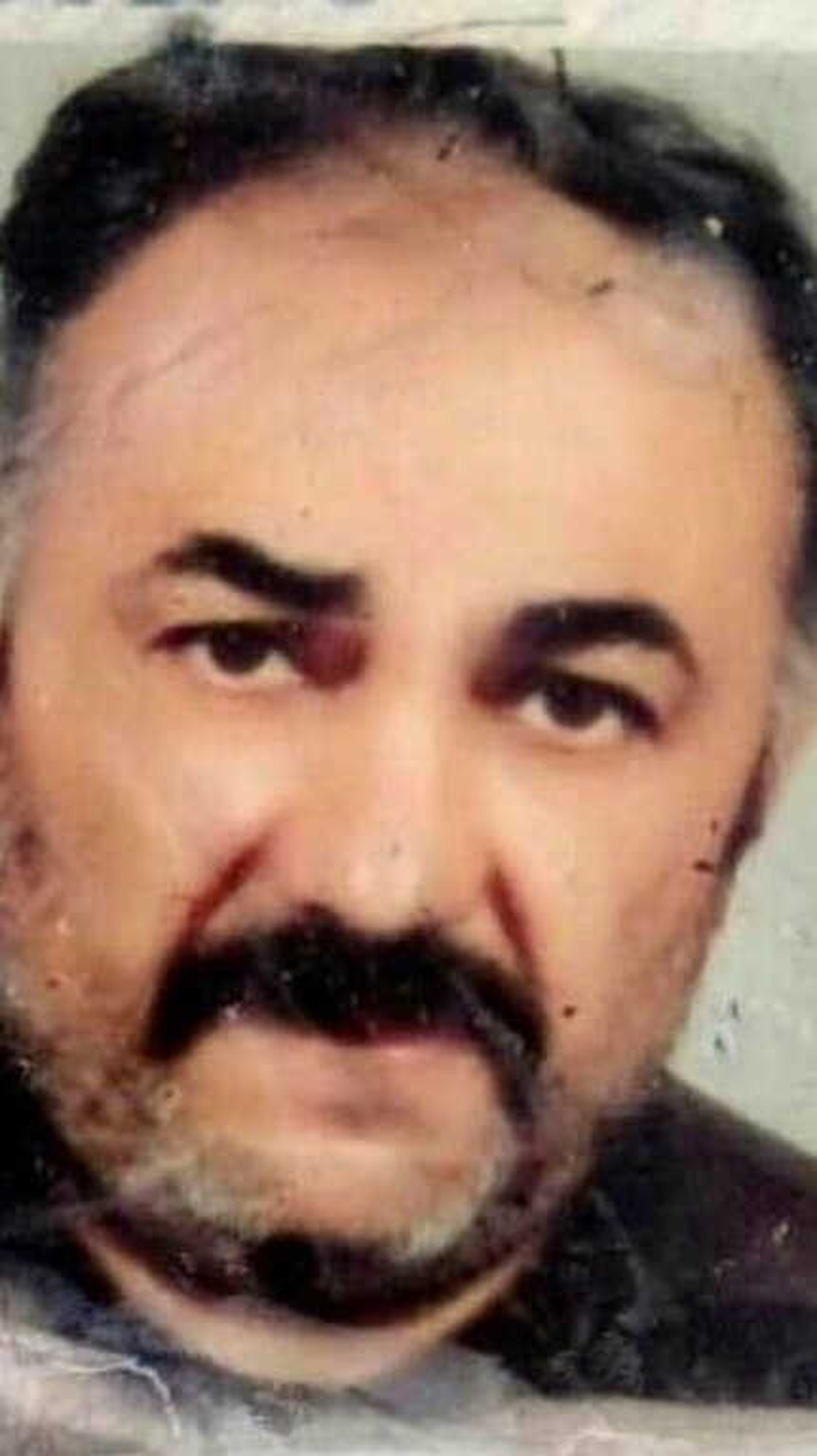 Kanser Hastası Adam Kalp Krizi Geçirerek Hayatını Kaybetti