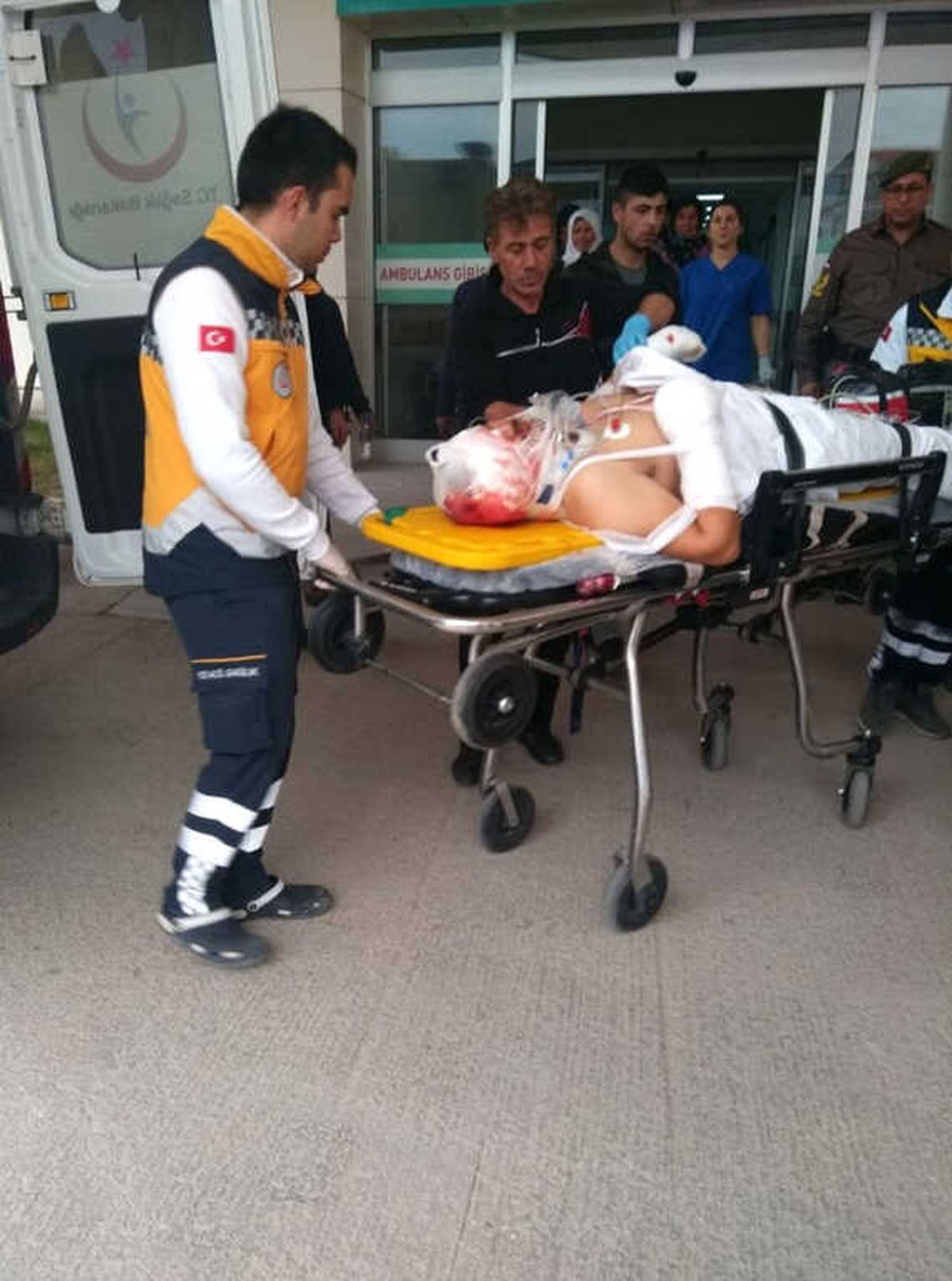 Torpille Oynayan İzinli Asker Gözünü ve Parmaklarını Kaybetti