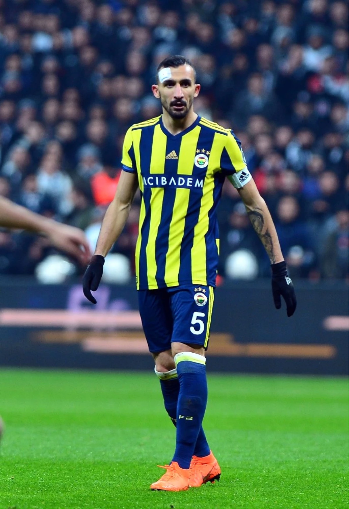 Mehmet Topal\'ın Kafası Yarıldı