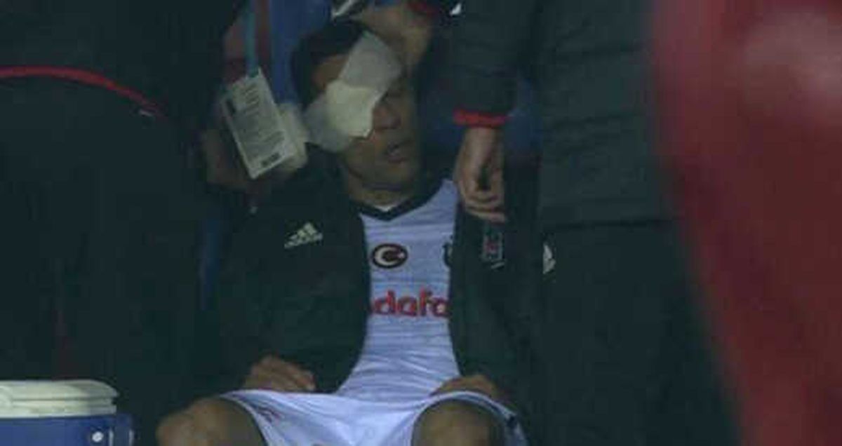 Beşiktaş\'ta Adriano Oyuna Devam Edemedi