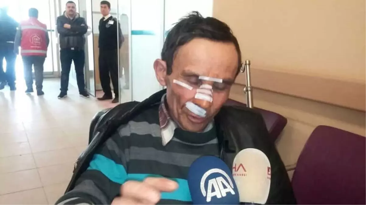 Çorum\'daki Kazadan Yaralı Kurtulan Yolcu: "Camdan Atlayarak Kurtulduk"