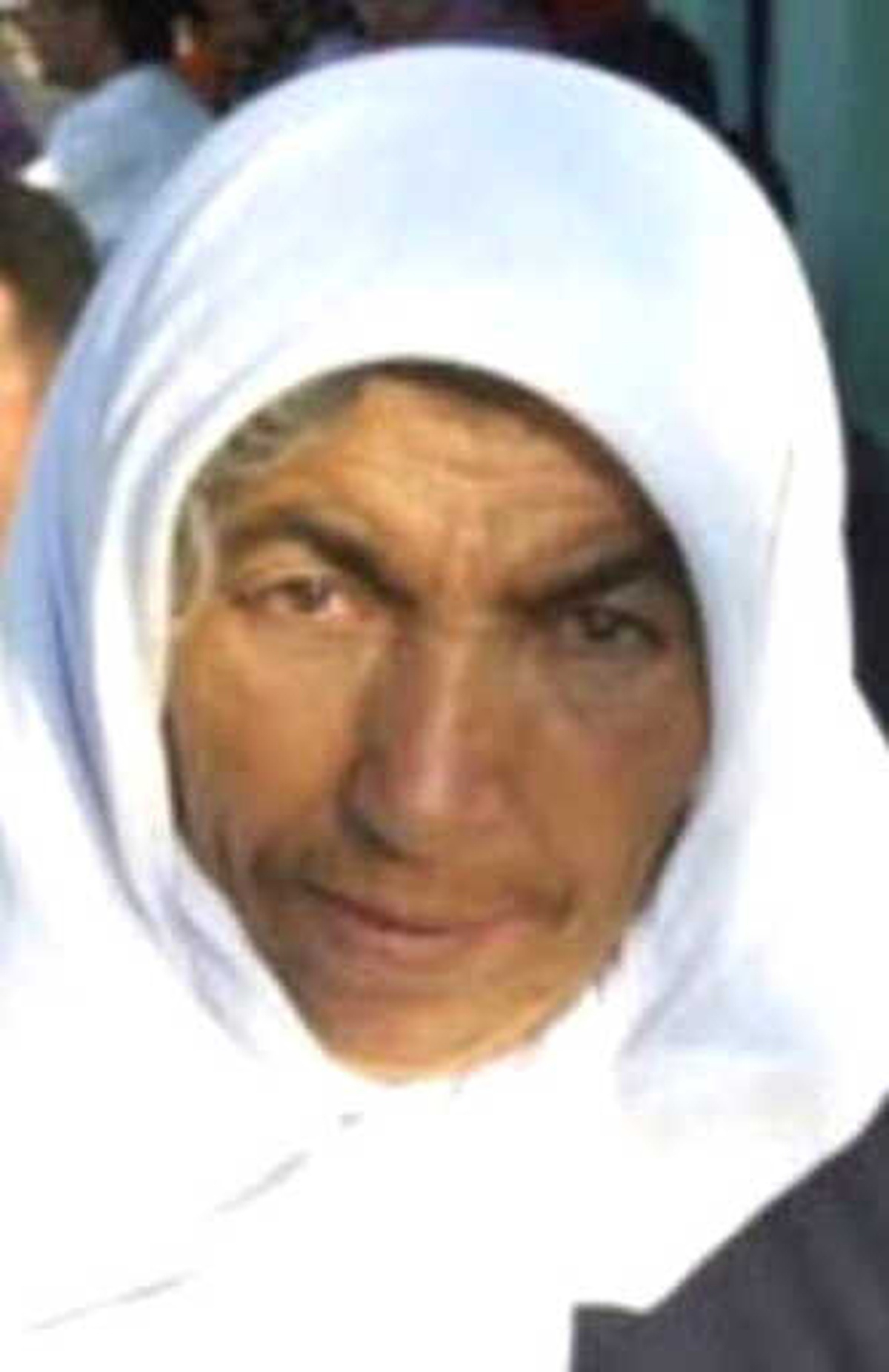 Tırın Altında Kalarak Bacağı Kopan Yaşlı Kadın Hayatını Kaybetti