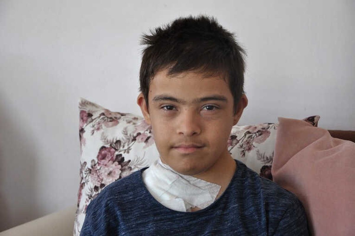 Down Sendromlu Süleyman 10 Yıldır Organ Bekliyor