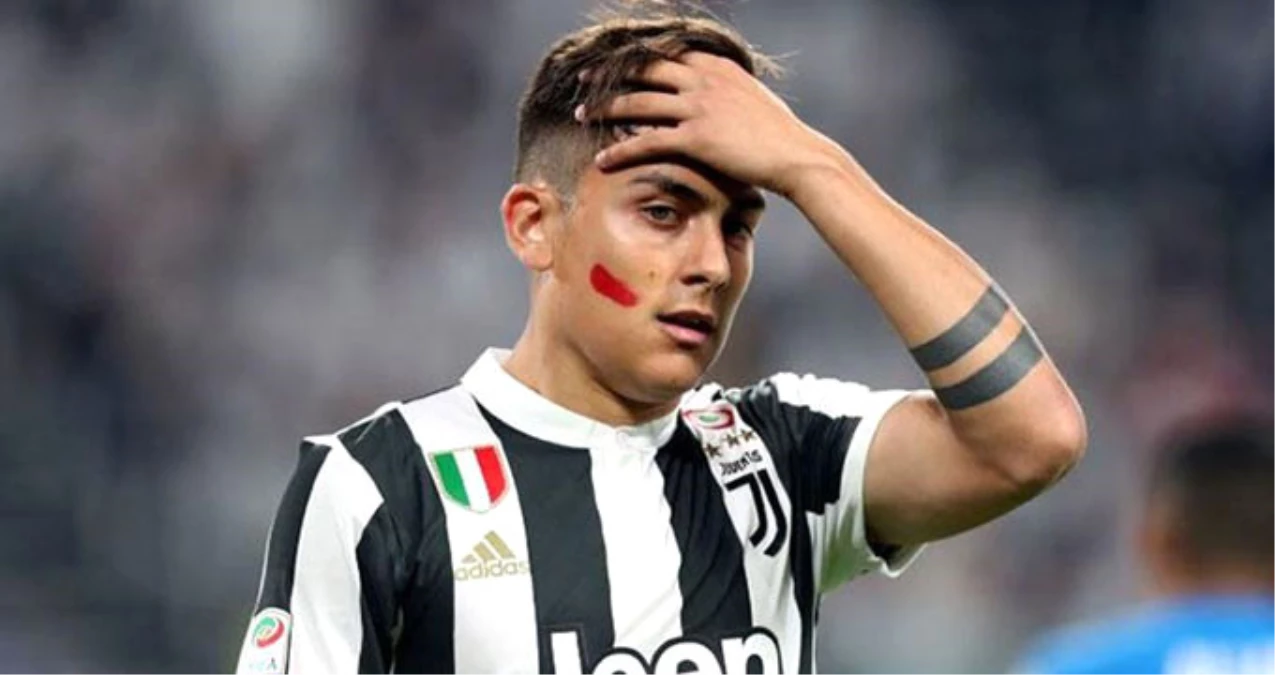 Juventuslu Futbolcular Aile İçi Şiddet Konusunda Farkındalık İçin Yanaklarına Ruj Sürdü