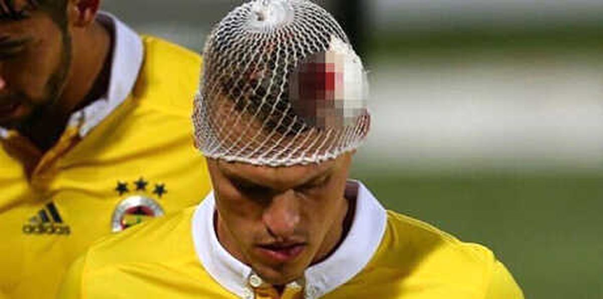 Fenerbahçeli Skrtel Kanlar İçinde Kaldı!