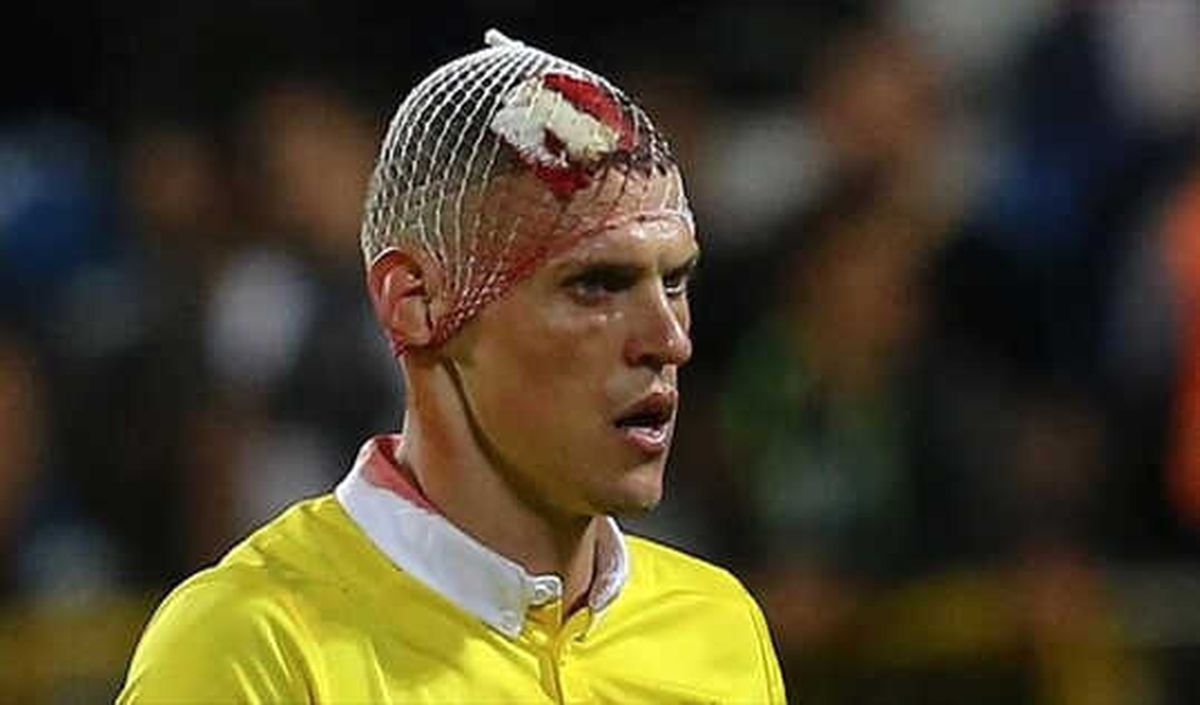 Fenerbahçe\'de Skrtel\'in Başına 10 Dikiş Atıldı