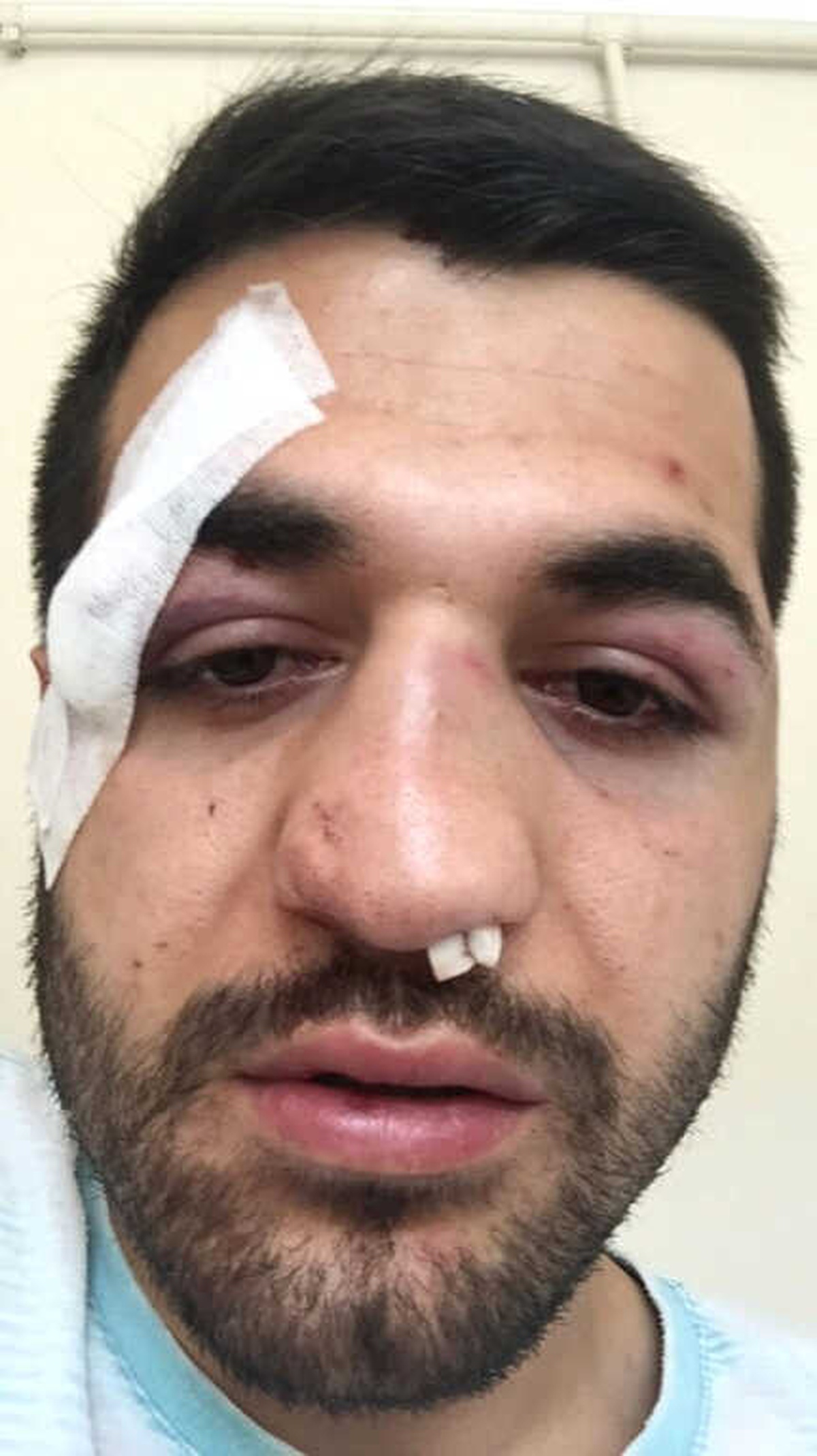 Sokak Kavgasında Sandalyeler Havada Uçuştu