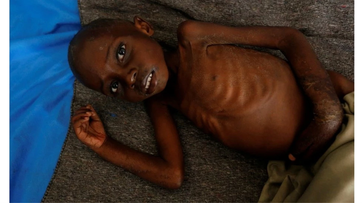 Demokratik Kongo Cumhuriyeti\'nde 400 Bin Çocuk Açlıkla Karşı Karşıya