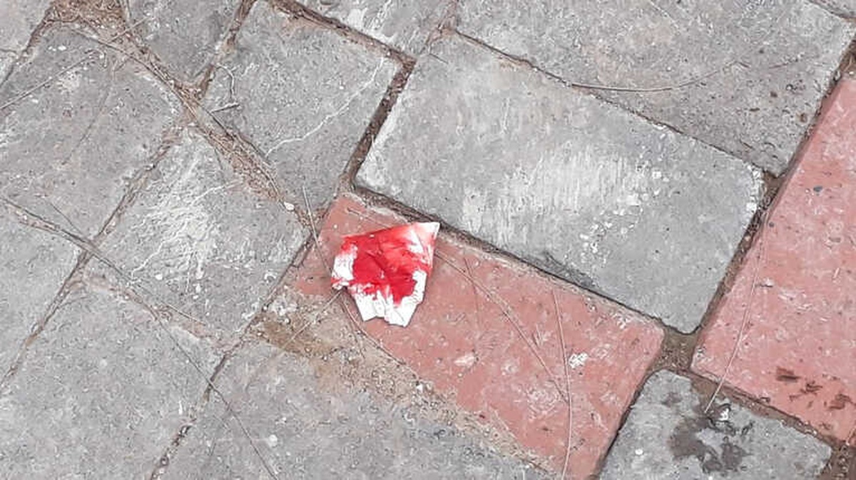 Parkta Oyun Onarken Ayağı İpe Takılan Çocuk Hastanelik Oldu