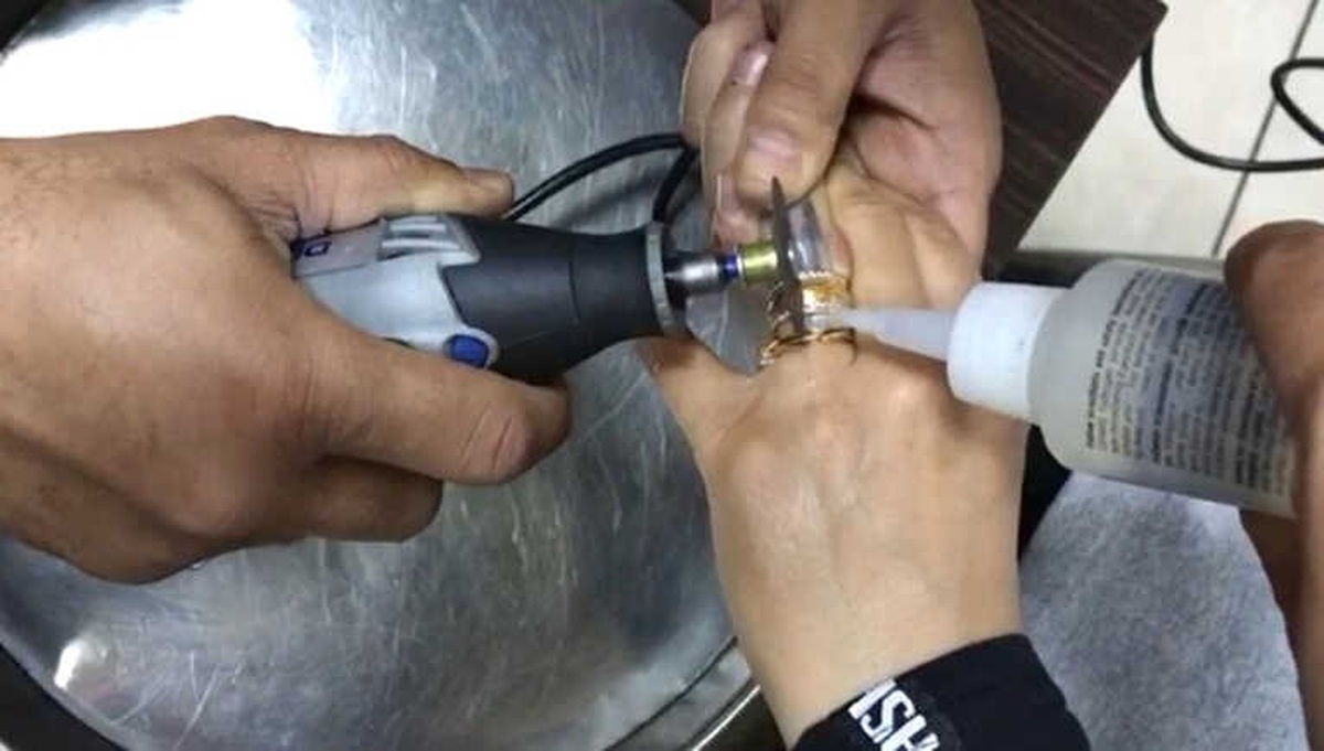 Genç Kızın Parmağında Sıkışan Yüzüğü İtfaiye Çıkardı