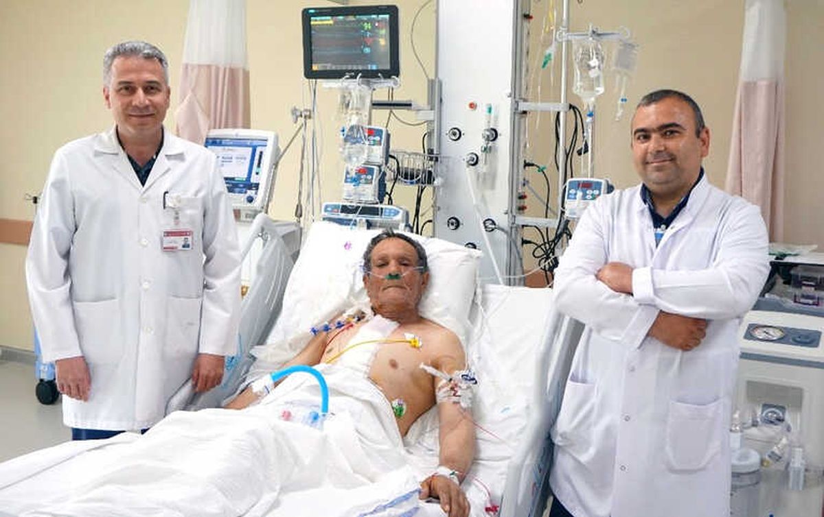 Çomü Araştırma Hastanesinde Bentall Ameliyatı Yapıldı