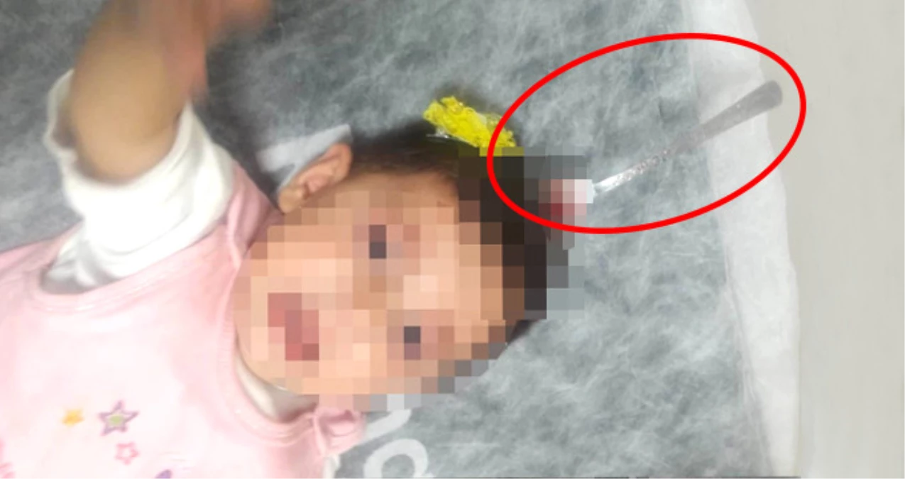 İzmir\'de Akılalmaz Olay! Bebeğin Kafasına Çatal Saplandı