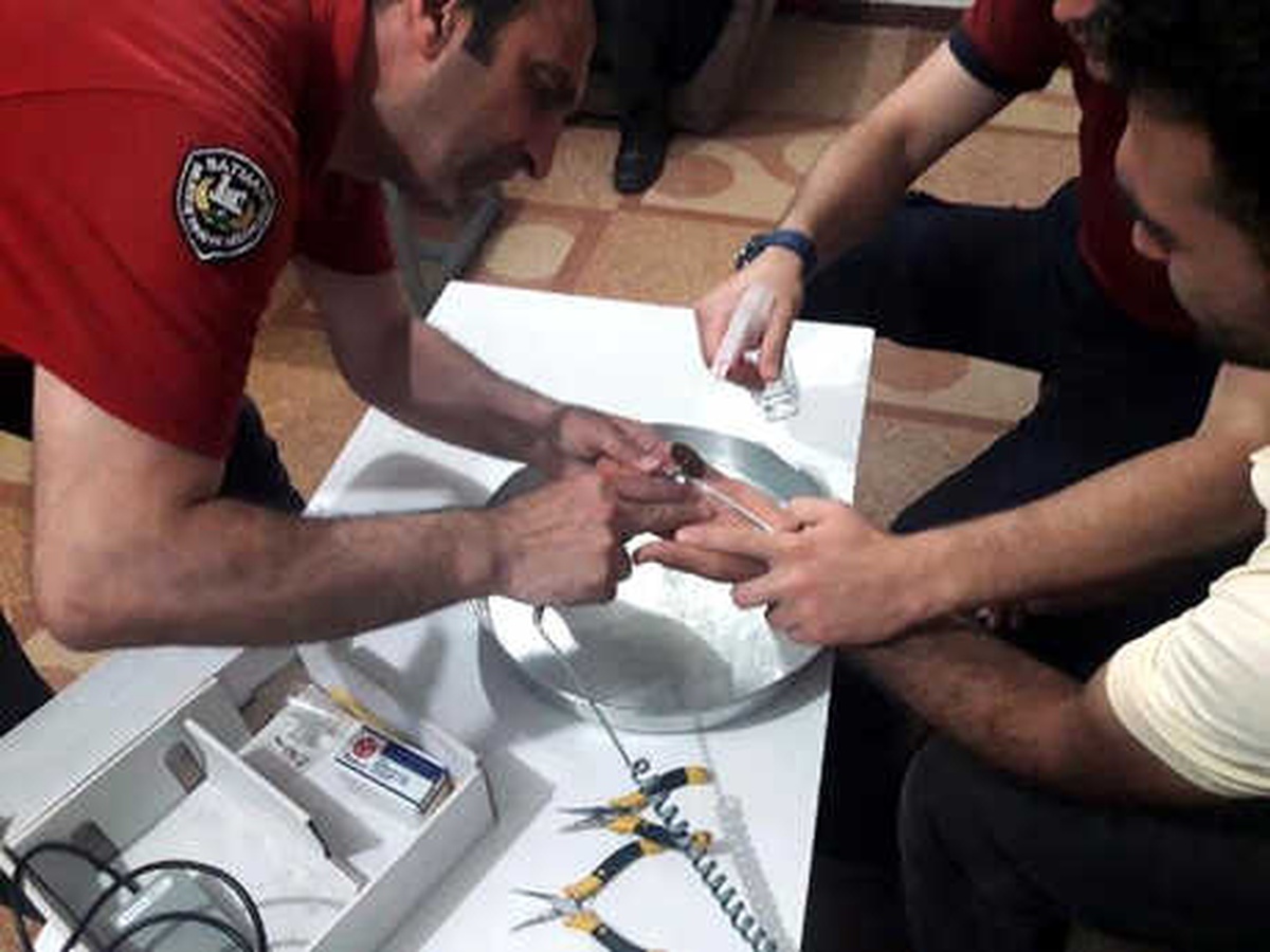 Parmağı Sıkıştıran Yüzüğü İtfaiye Çıkardı