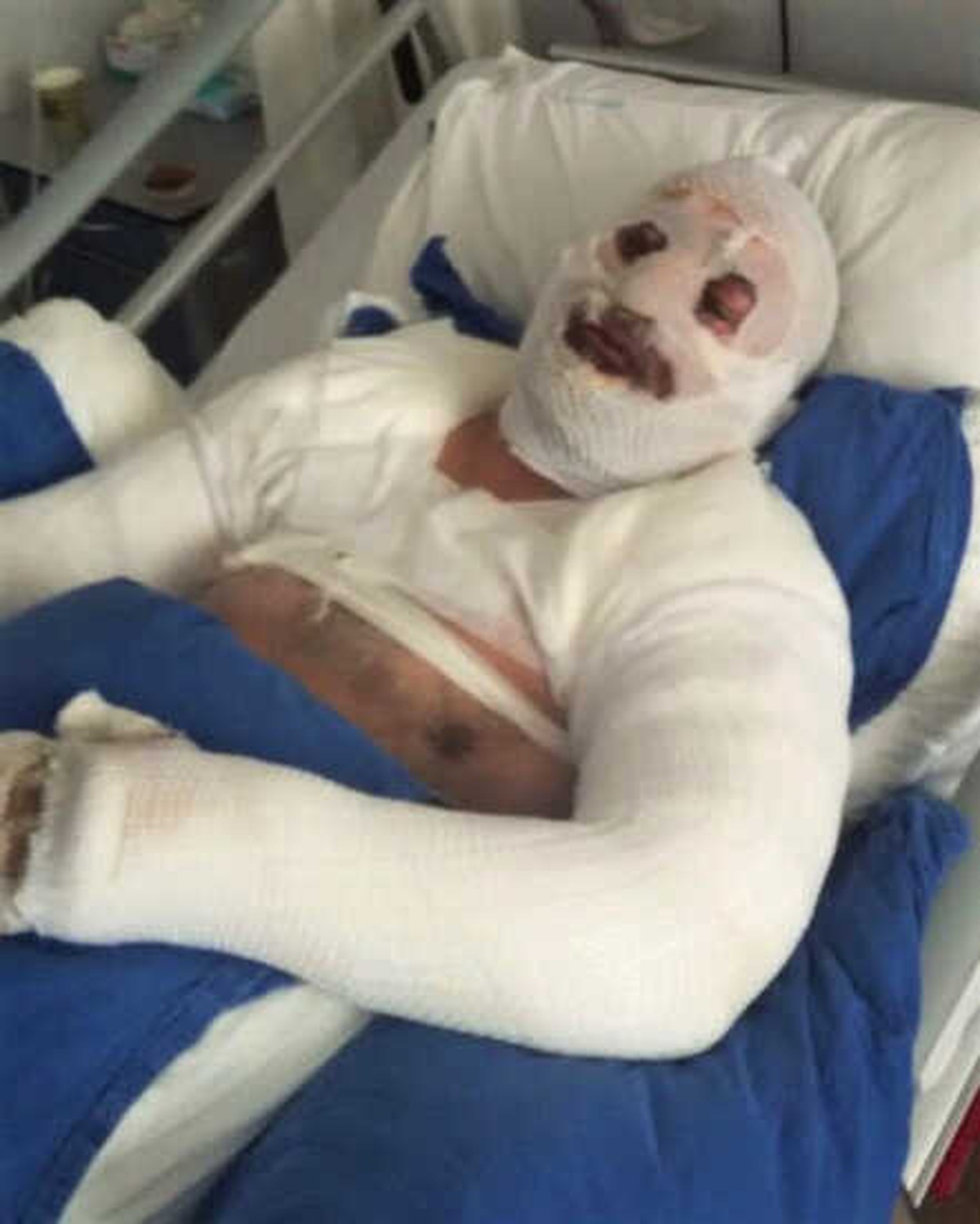 Banyoda Yaşanan Patlama Bu Hale Getirdi