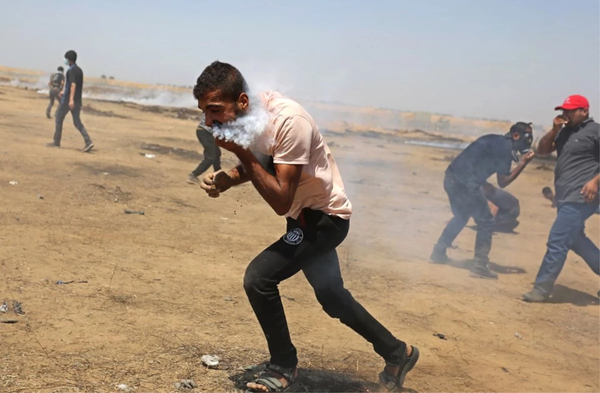 Ağzına Gaz Bombası İsabet Eden Filistinli, Tedavi İçin Gazze\'den Çıkmayı Bekliyor