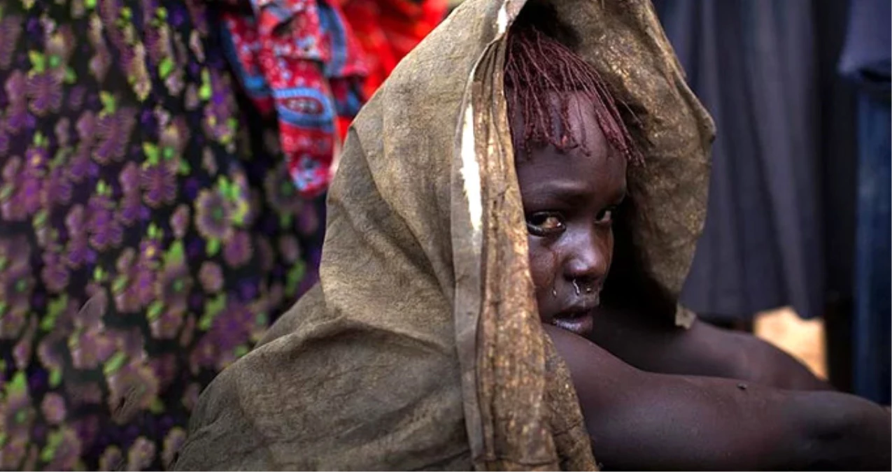 Somali\'de, Sünnet Edilen 10 Yaşındaki Kız Çocuğu Kan Kaybından Öldü