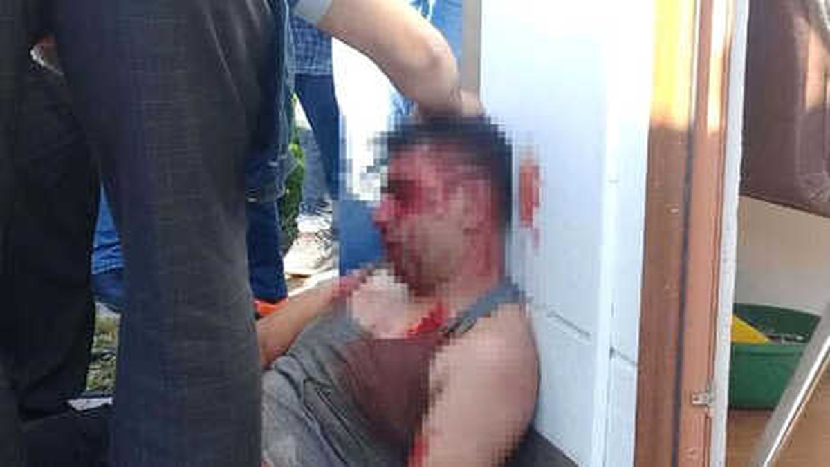 Linçten Kurtarılan Taciz Zanlısı Tutuklandı