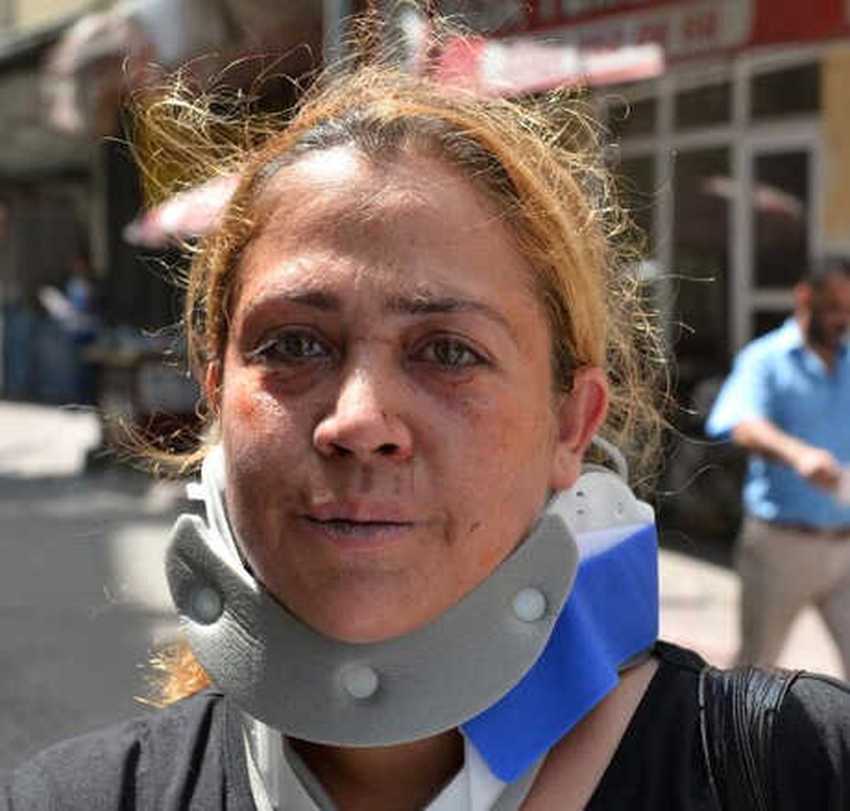 Komşusunun Uyardığı İçin Parke Taşıyla Dövüldü