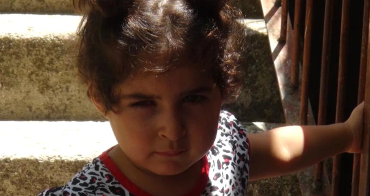 3 Yaşındaki Kübra Ameliyat Sonrası Sağ Gözünü Kaybetti!
