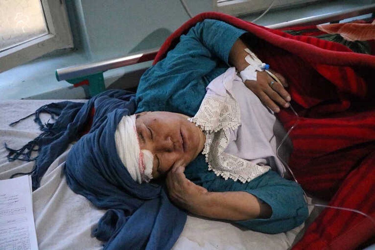 Afganistan\'da Saldırıların Temmuz Ayı Bilançocu: 232 Ölü