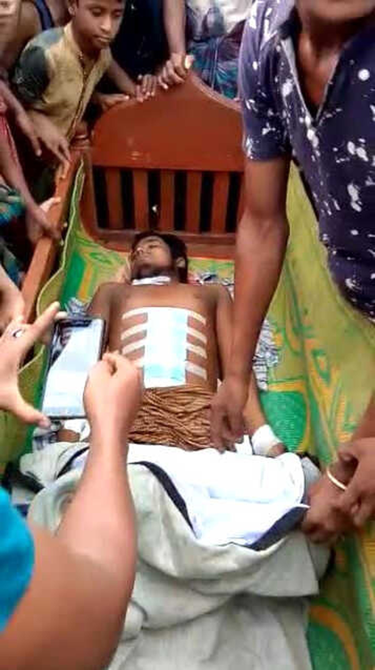 Bangladeş\'te Arakanlı Müslümanın Hastanede Organları Çalındı