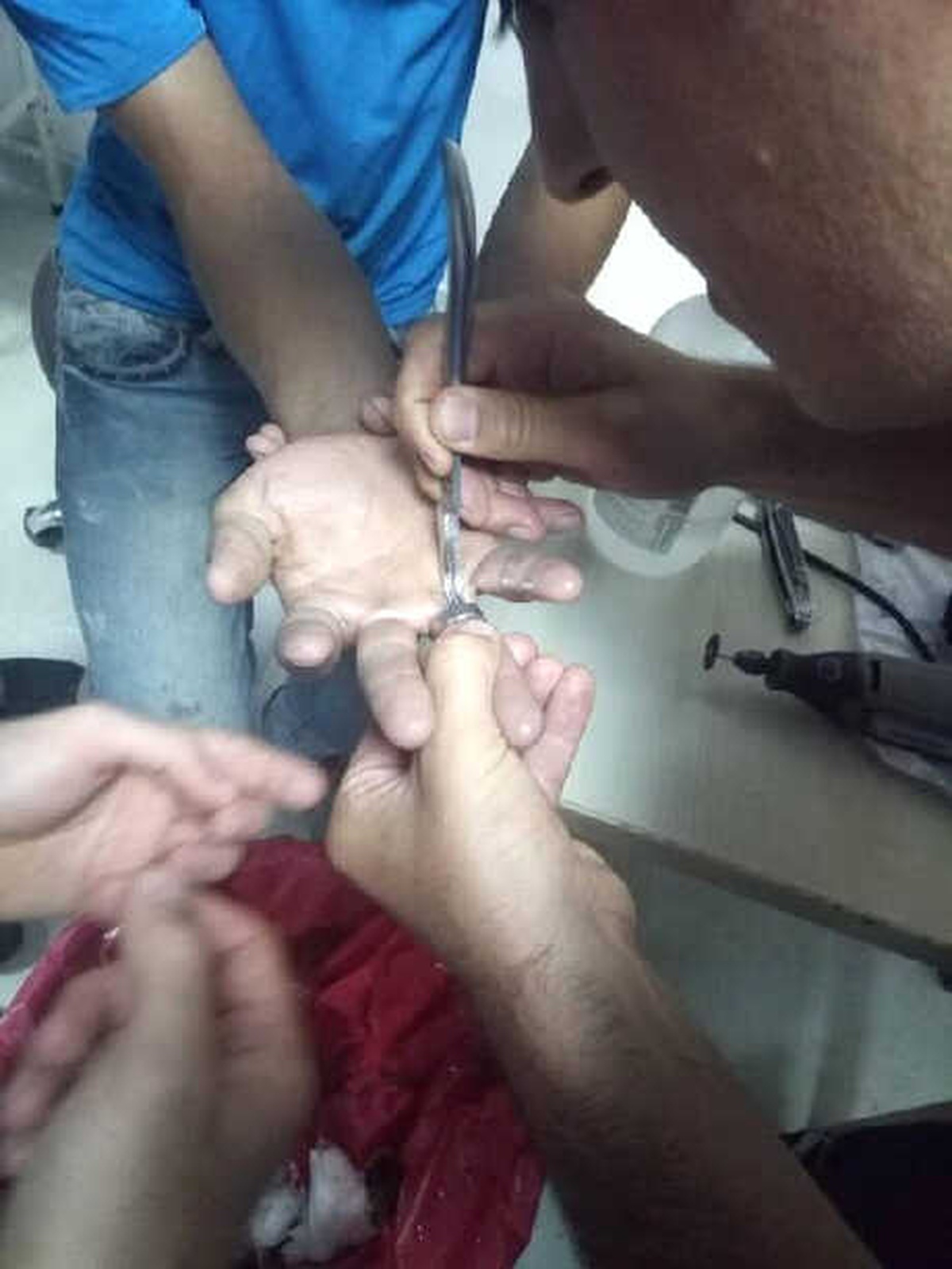 Parmağında Sıkışan Yüzüğü Afad Ekibi Çıkardı
