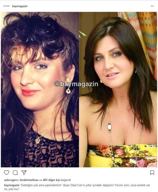 İmparator, Sibel Can’ın “Estetiksizim“ Açıklamasına Destek Verdi