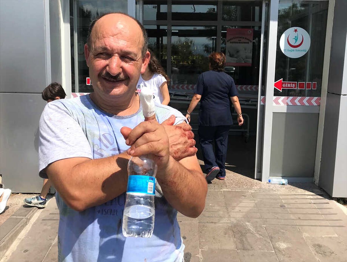 Acemi Kasaplar" Hastanelik Oldu