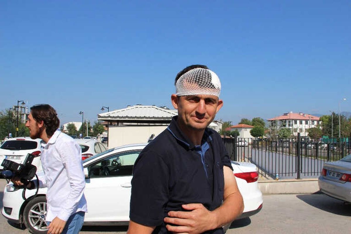 Acemi Kasaplar Kendini Yaraladı