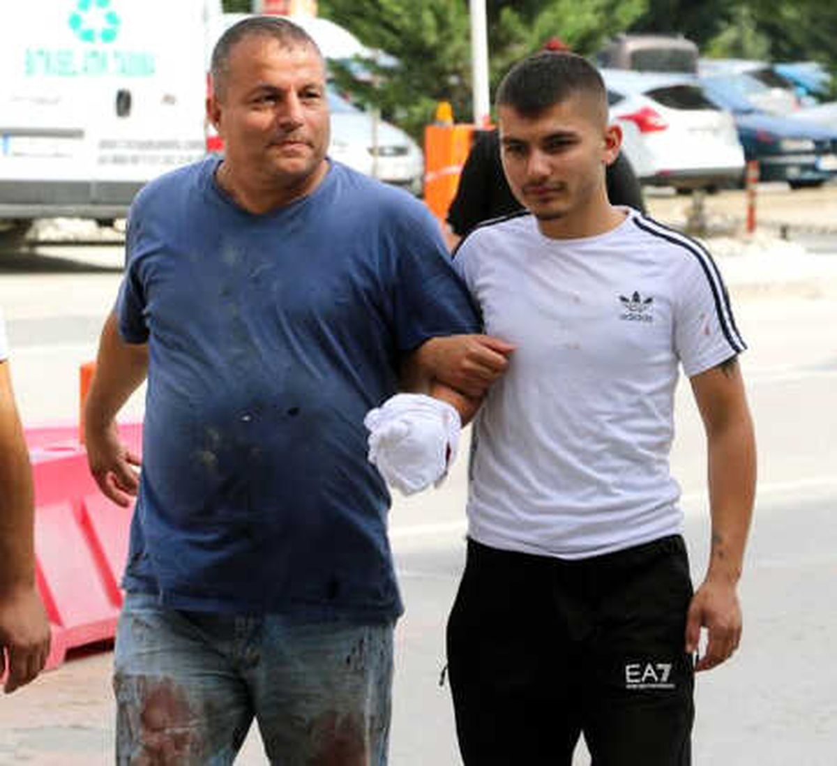 Samsun\'da Acemi Kasaplar Kendilerini Yaraladı