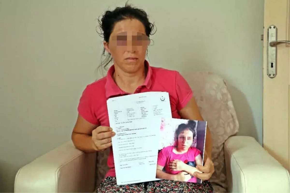 İstanbul\'dan Gelen Kızına Pasta Sürprizi Yapmak İstedi, Hastanelik Oldu