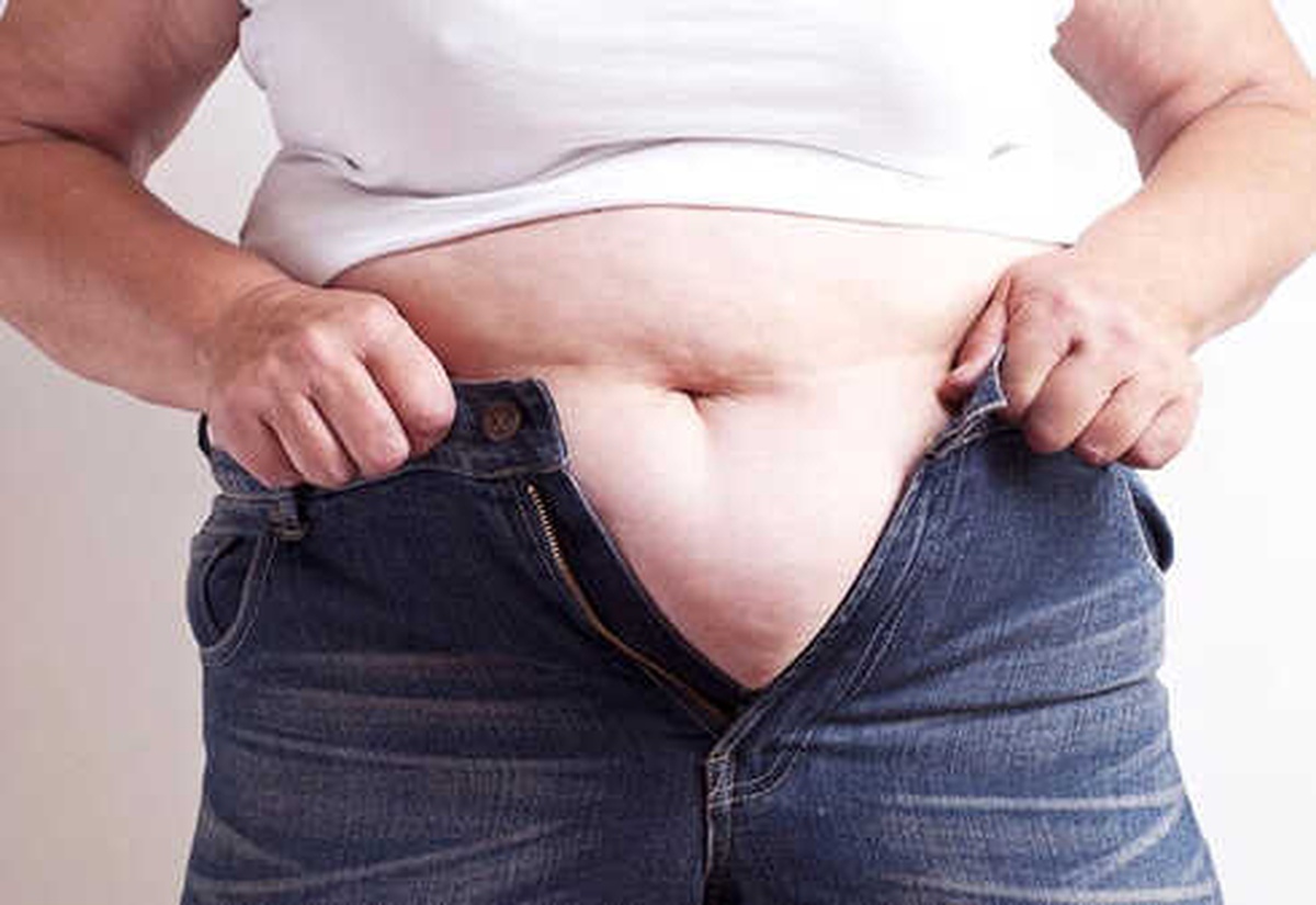 Obezliğin Suçlusu Açlık Hormonu Neşterle Pes Ediyor