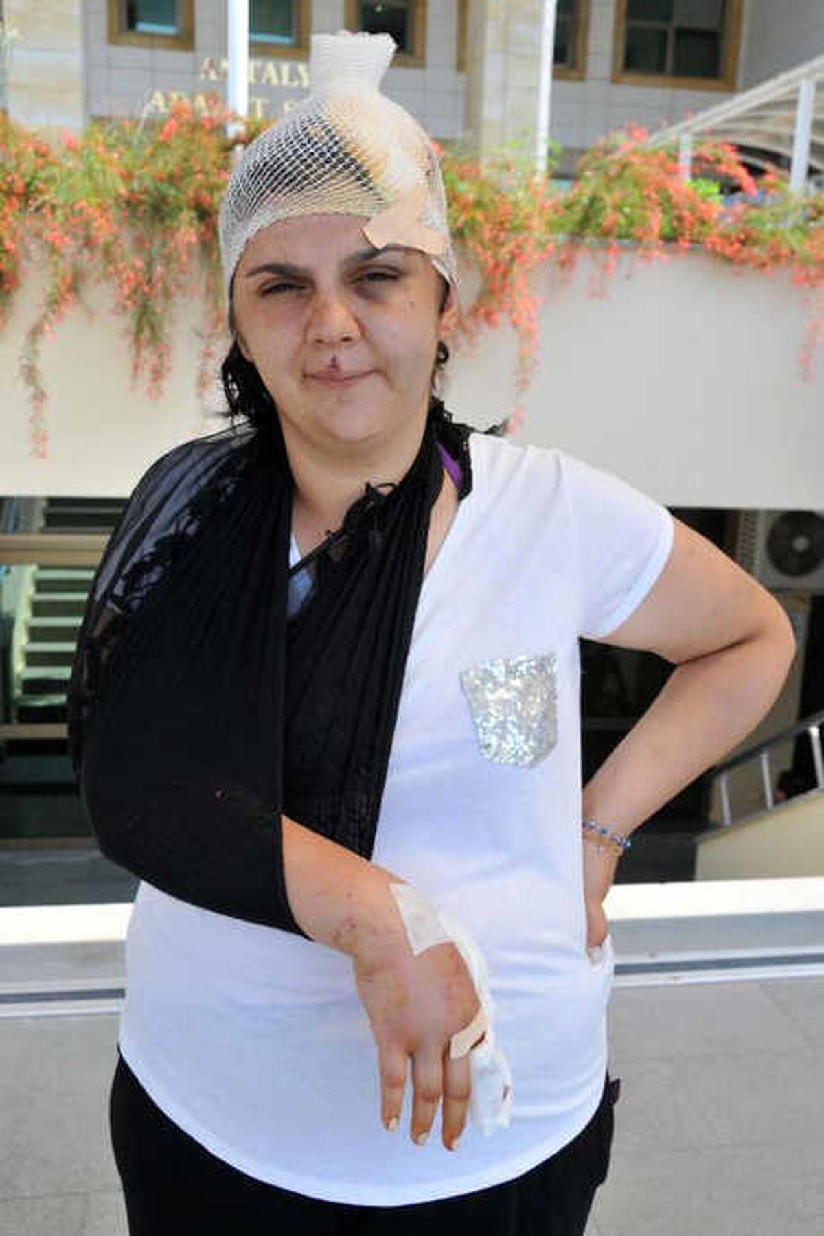 Boşanmak İstediği Eşi Kolunu Kırdı, Başına 50 Dikiş Atıldı