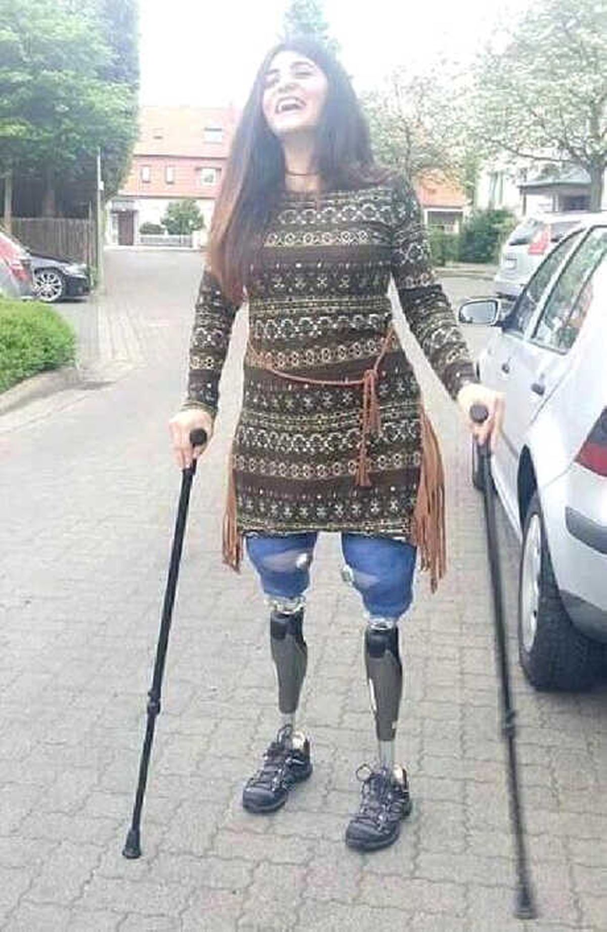 İki Bacağını Kaybeden Dansçı Lisa\'ya 1 Milyon 356 Bin Tazminat Kararı