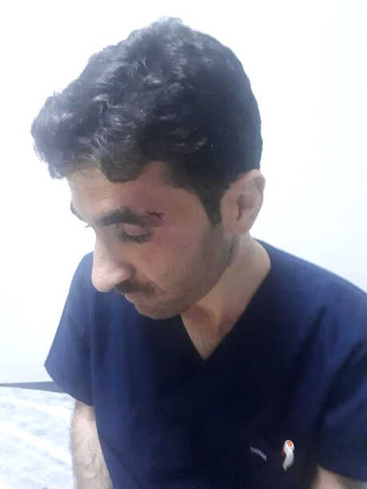 Akçakale\'de Erkek Hemşire Dövüldü