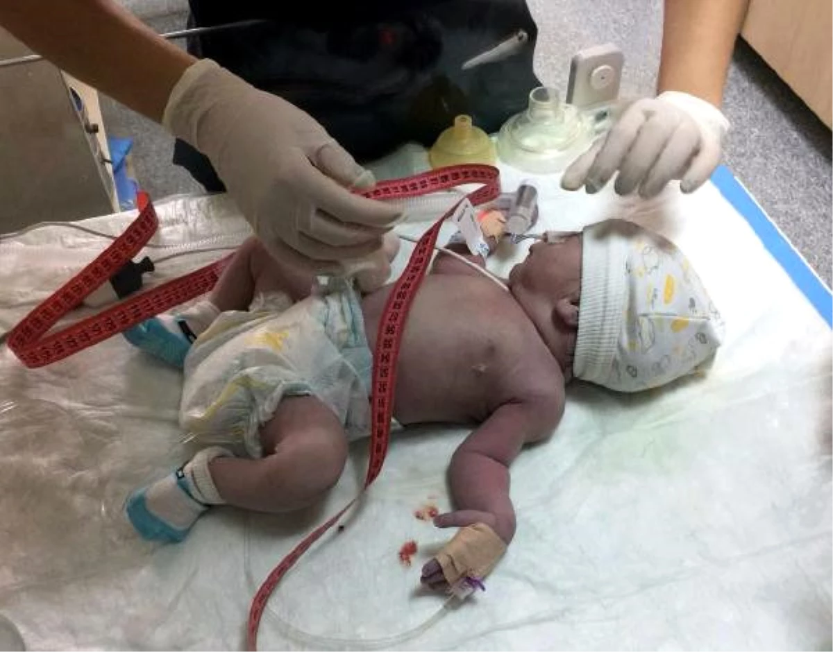 Kalp Bulunamadı, Ömer Bebek Sadece 17 Gün Yaşayabildi