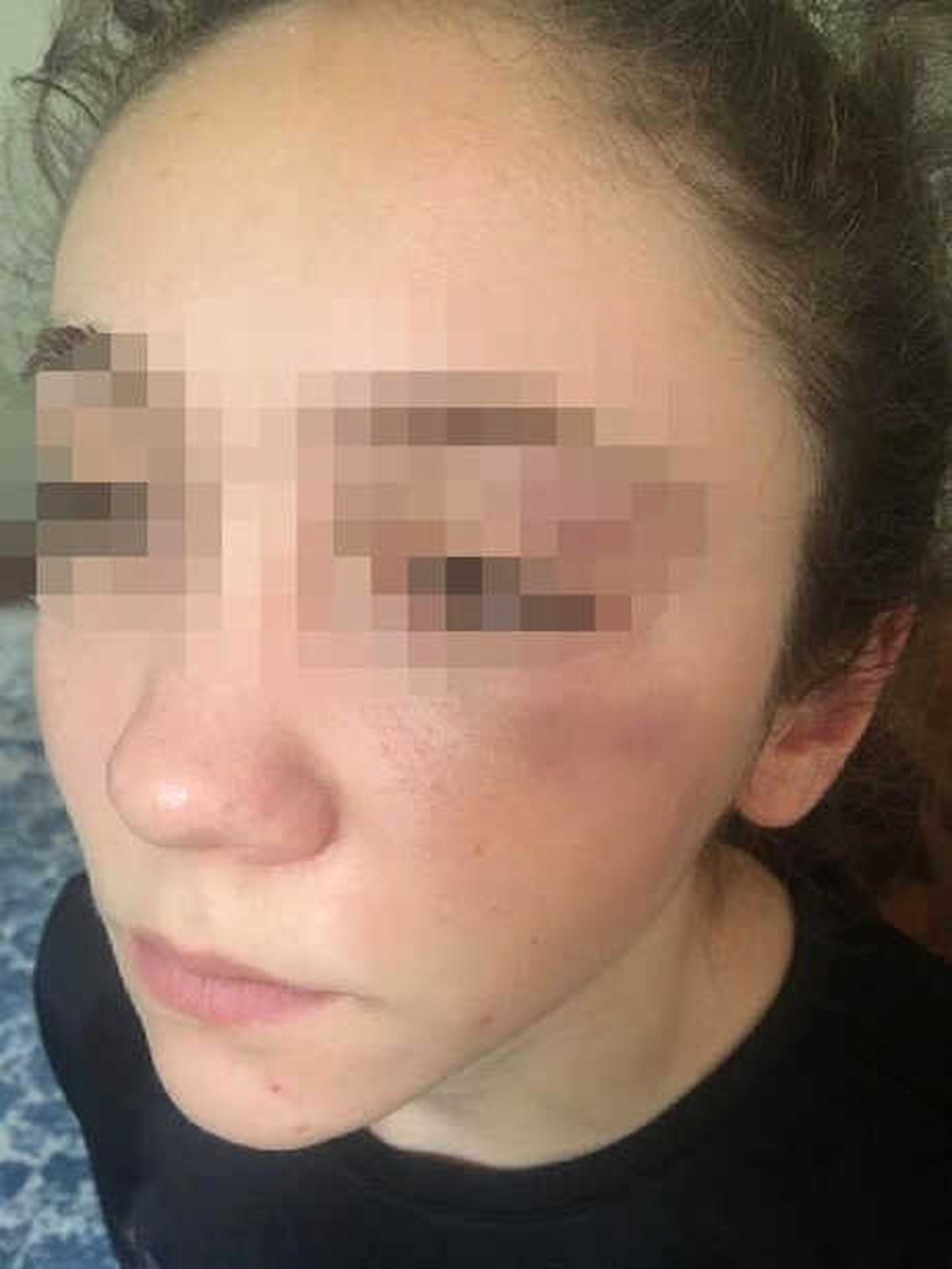 Antrenör, 14 Yaşındaki Milli Karateciyi Yumrukla Dövdü\' İddiası