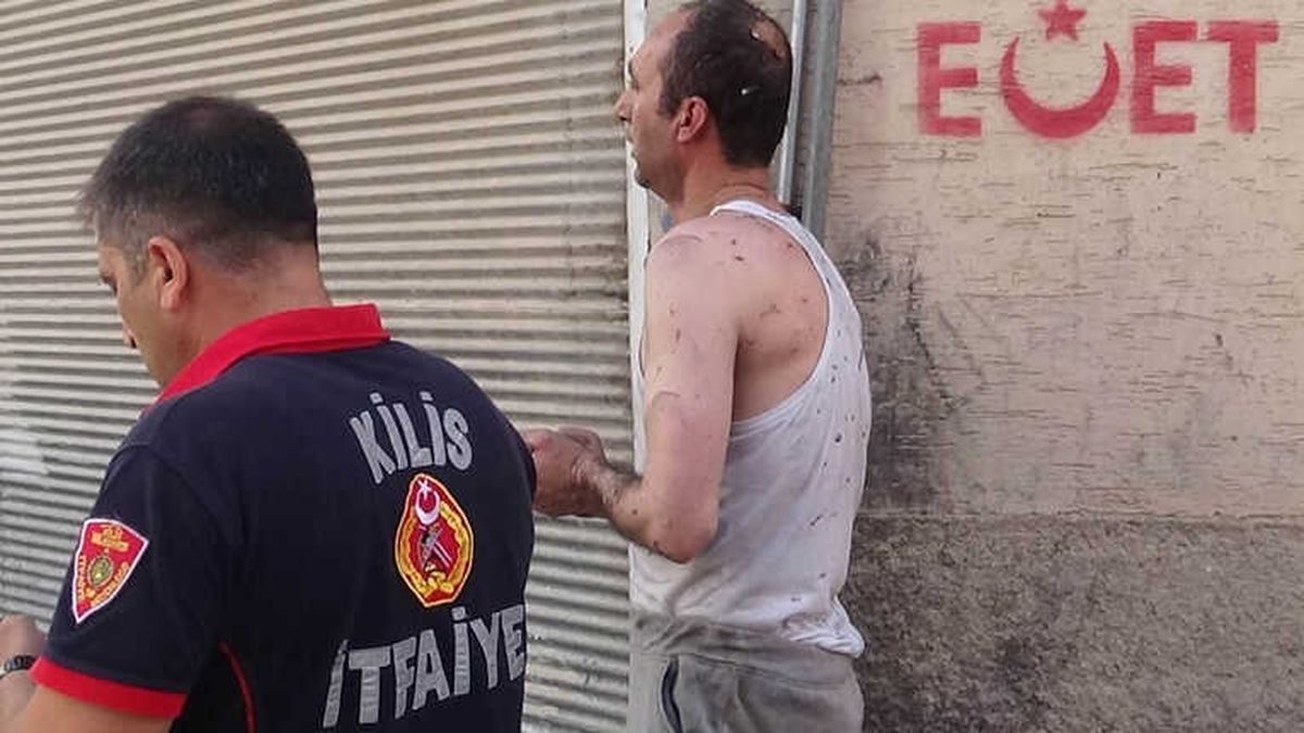 Kilis\'te Ev Yangını: 1 Yaralı