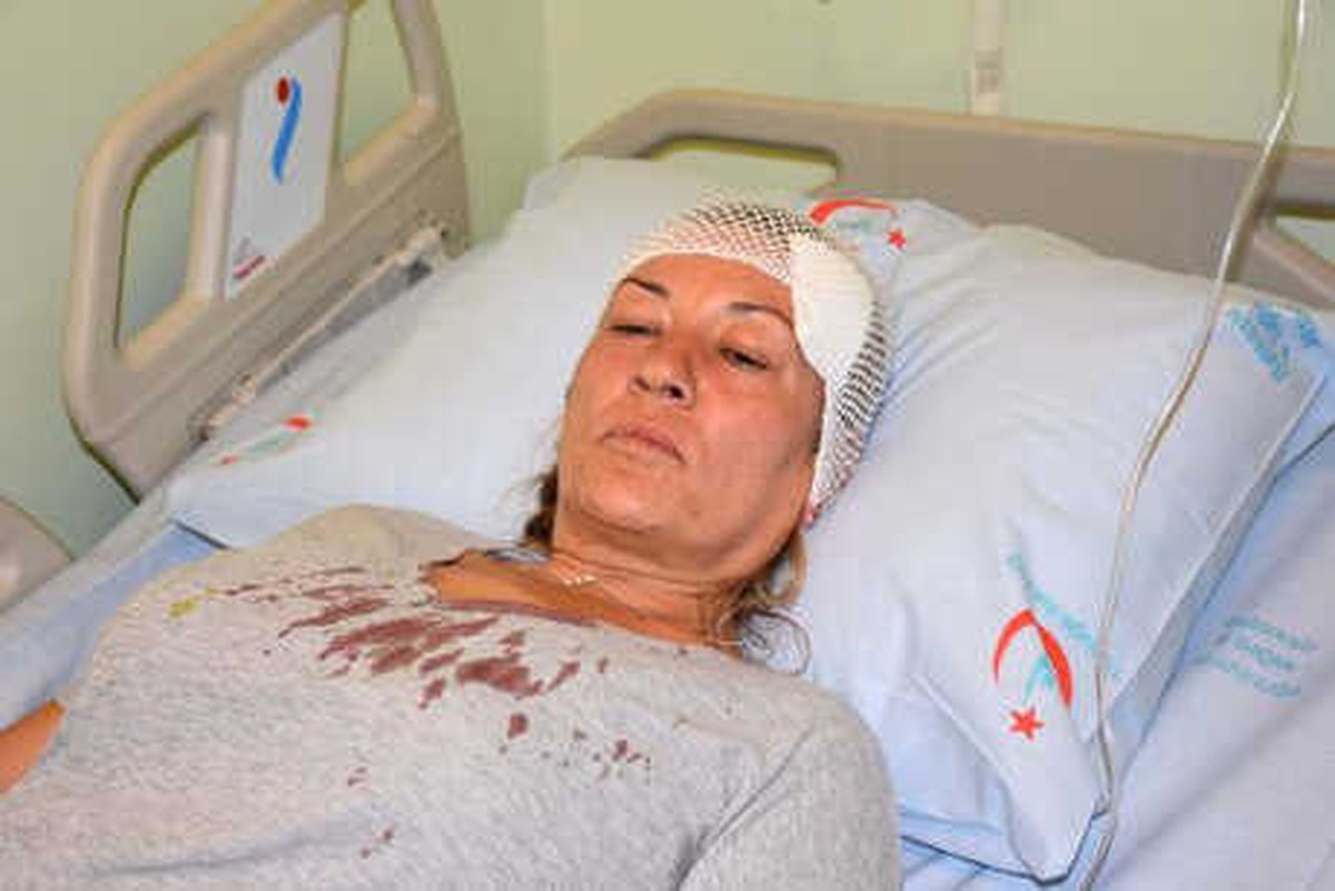 Sokak Hayvanlarını Besleyen Kadın Komşusunu Taşla Yaraladı
