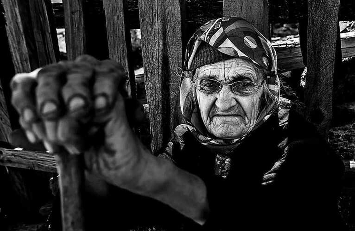 Açık Tenlilerin Cildi Daha Çabuk Yaşlanıyor"