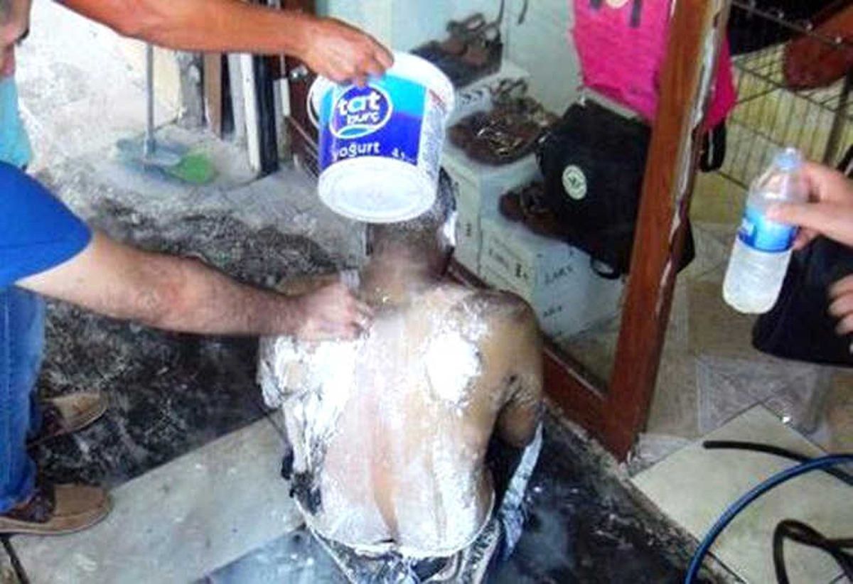 Üzerine Benzin Döküp Kendini Ateşe Verdi