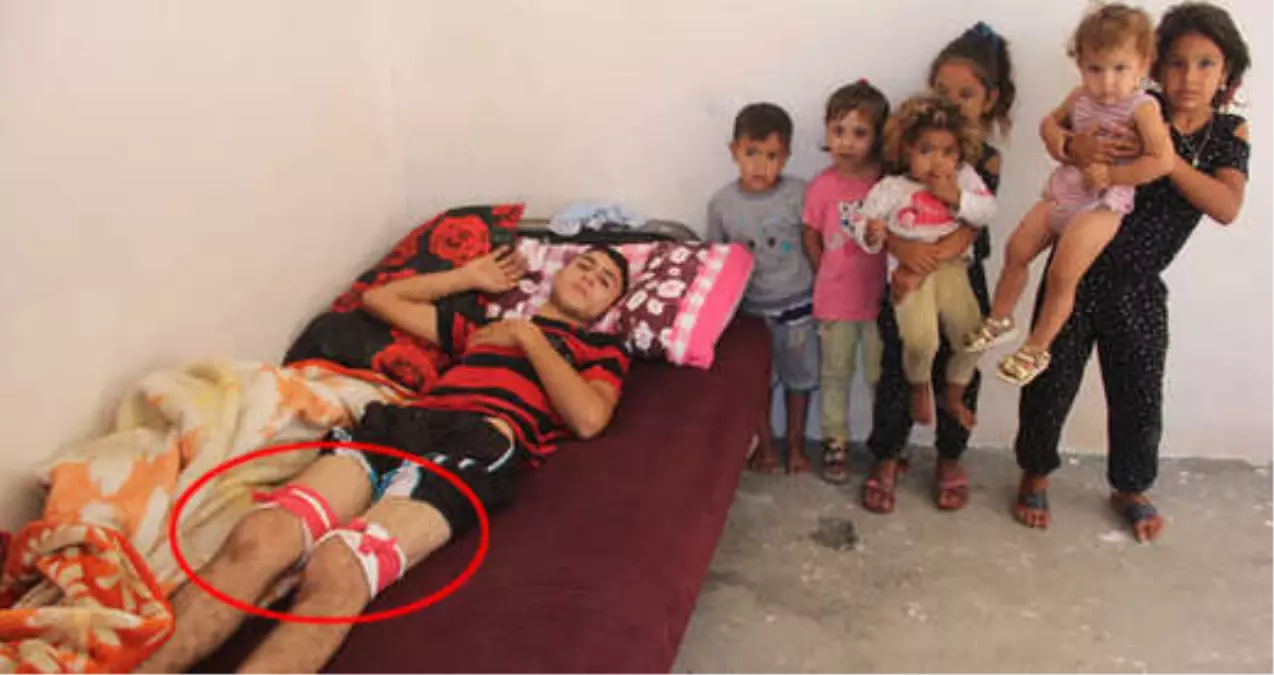 Facebook\'ta Fotoğrafına Yorum Yapan Saldırganla Tartıştı, Bacaklarından Vuruldu!