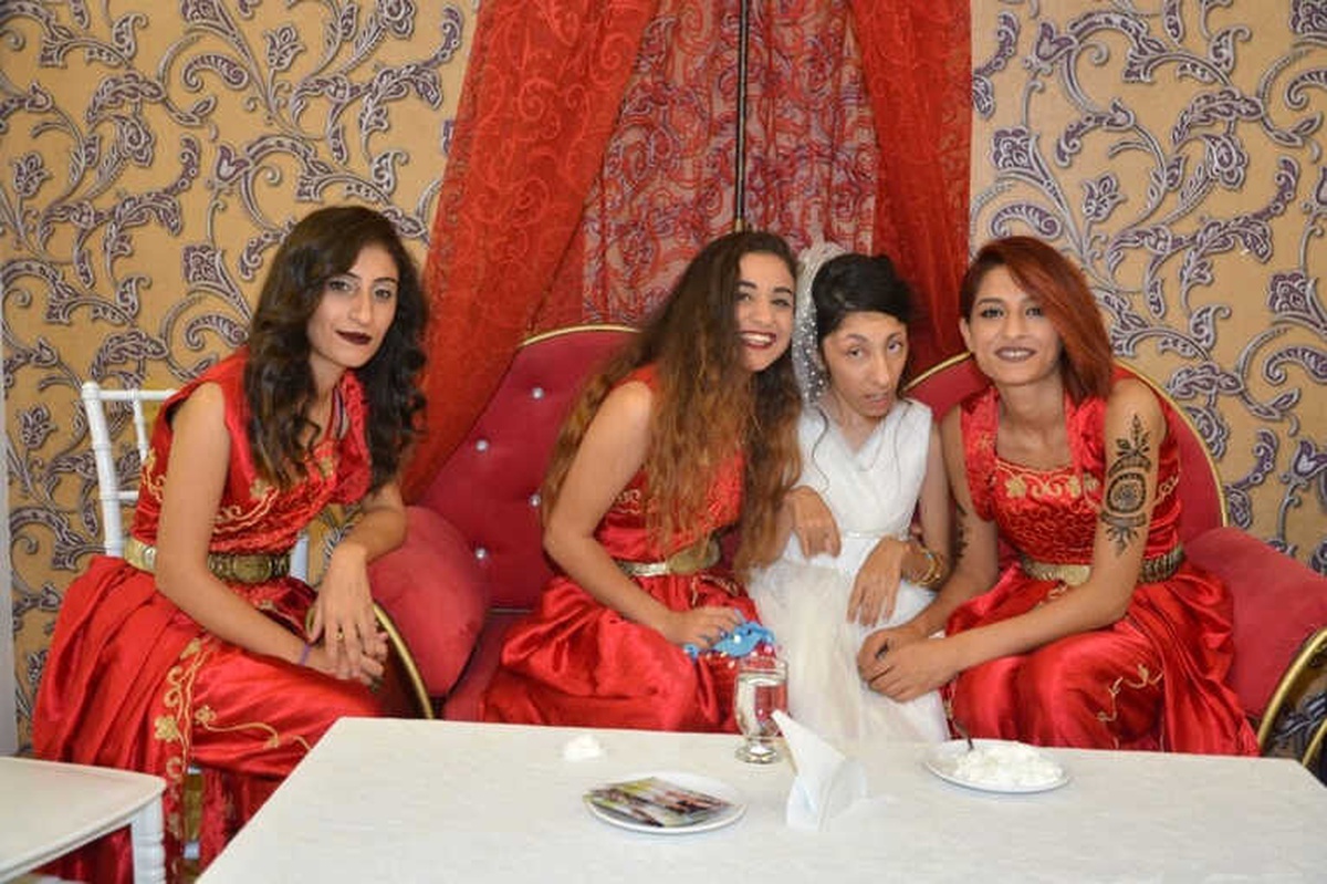 Berna\'ya Damatsız Düğün