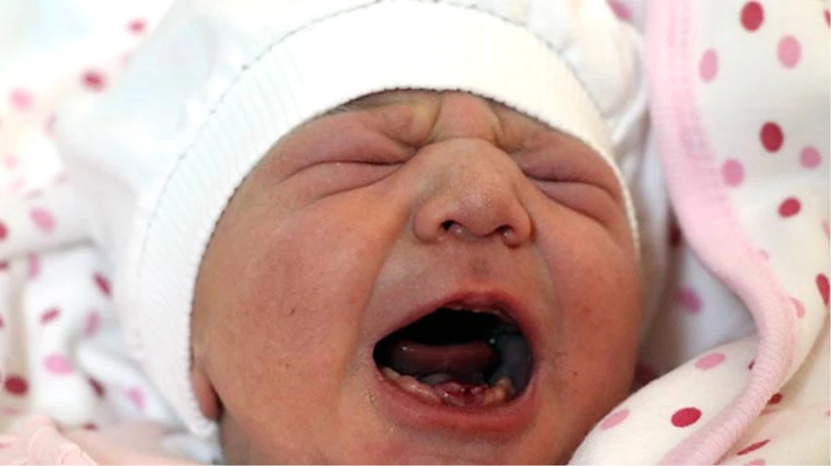 Amasya\'da Dokuz Dişli Bebek Dünyaya Geldi