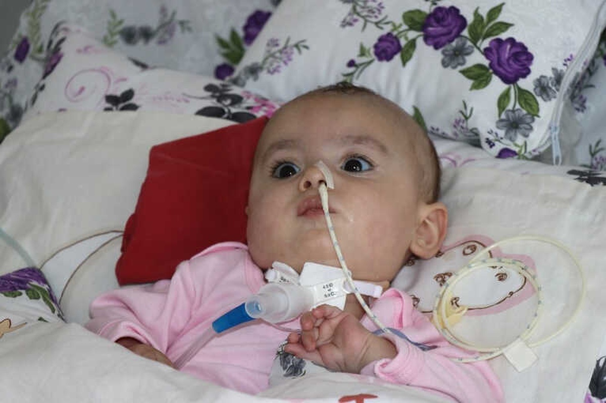 Sma Hastası 8 Aylık Hafsa Nur Hayatını Kaybetti